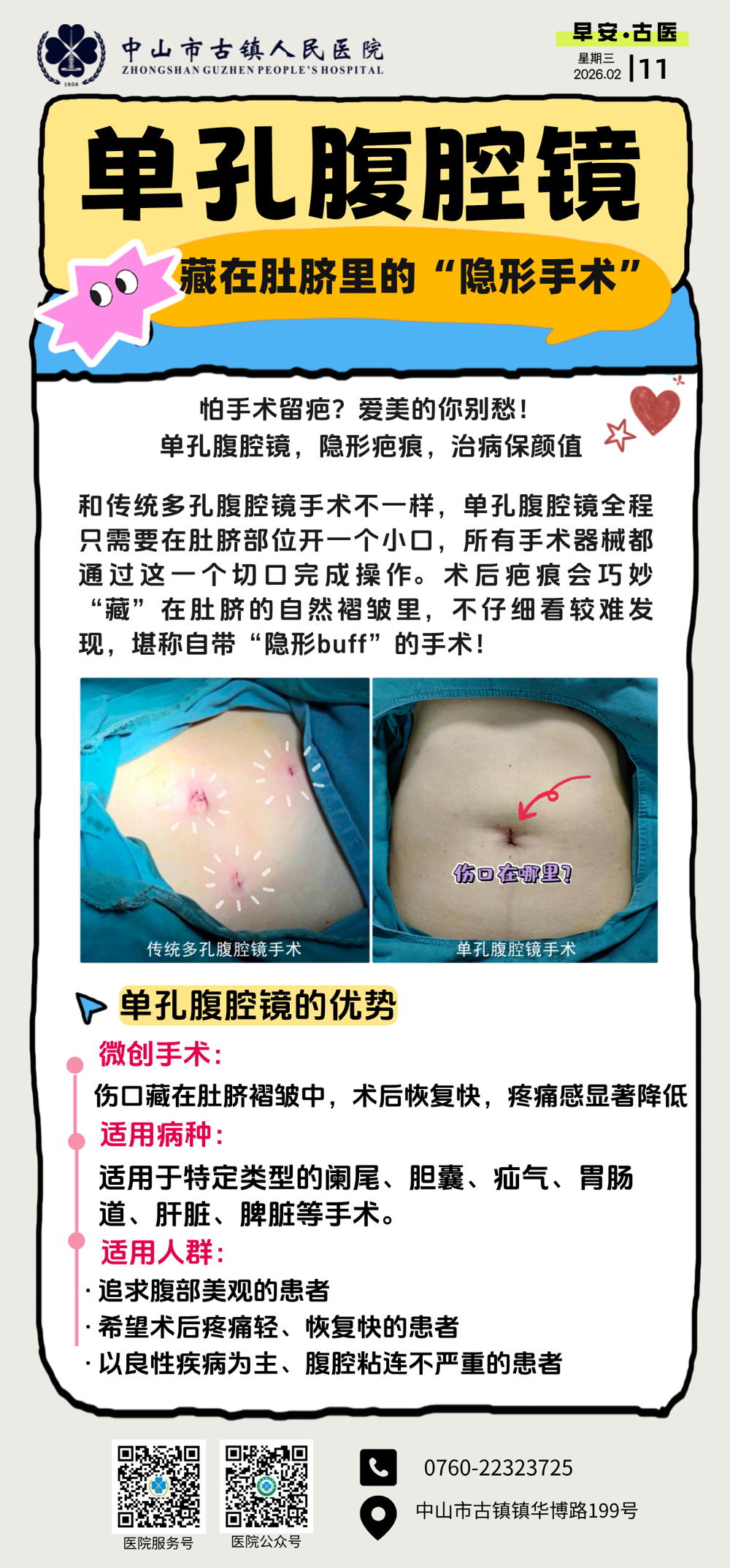 2.11 普外科-单孔腹腔镜